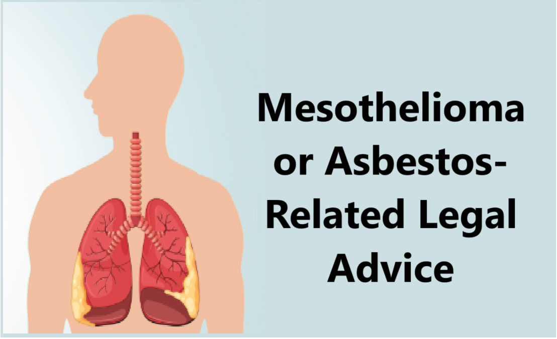 Mesothelioma or Asbestos-Related Legal Advice: Your Path to Justice and Compensation